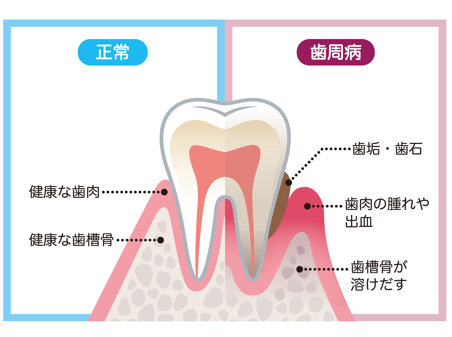 その原因は？